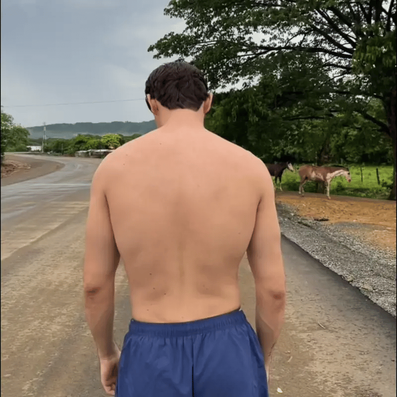 Kyvento Posture™ | Corrector de Postura.